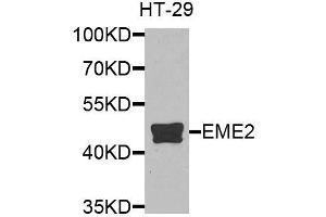 Western blot analysis of extracts of HT-29 cells, using EME2 antibody (ABIN6003623) at 1/1000 dilution. (EME2 Antikörper)