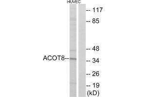 Western blot analysis of extracts from HUVEC cells, using ACOT8 antibody. (ACOT8 Antikörper  (Internal Region))