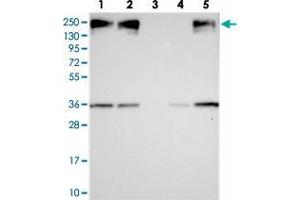 Western blot analysis of Lane 1: RT-4, Lane 2: U-251 MG, Lane 3: Human Plasma, Lane 4: Liver, Lane 5: Tonsil with ZC3H4 polyclonal antibody  at 1:250-1:500 dilution. (ZC3H4 Antikörper)