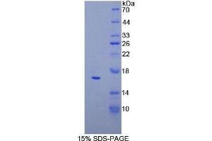 SDS-PAGE (SDS) image for CD160 (CD160) (AA 37-154) protein (His tag) (ABIN1878745)