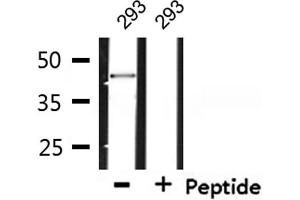 Western blot analysis of extracts from 293, using SYT Antibody.