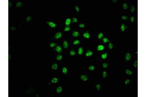 Immunofluorescence staining of Hela cells with ABIN7153409 at 1:67, counter-stained with DAPI. (GABPA Antikörper  (AA 268-372))