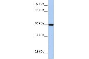 RDH11 antibody used at 1 ug/ml to detect target protein. (RDH11 Antikörper)