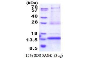 SDS-PAGE (SDS) image for CDKN2A Interacting Protein N-Terminal Like (CDKN2AIPNL) (AA 1-116) protein (His tag) (ABIN6387381)