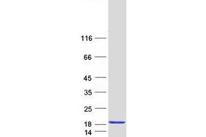 Western Blotting (WB) image for Calmodulin Like Protein 3 (CALML3) protein (Myc-DYKDDDDK Tag) (ABIN2713052)