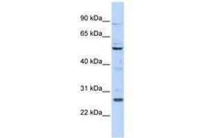 Image no. 1 for anti-Homeobox C5 (HOXC5) (N-Term) antibody (ABIN6740598)