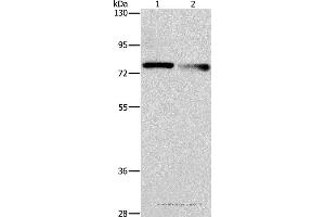 Western blot analysis of A549 and 231 cell, using NEK11 Polyclonal Antibody at dilution of 1:1000 (NEK11 Antikörper)