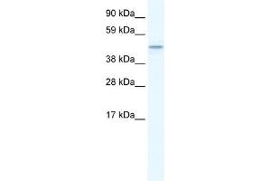 TMEM108 antibody used at 1. (TMEM108 Antikörper  (Middle Region))