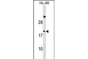 IFNA1 Antibody (C-term) (ABIN1536765 and ABIN2849630) western blot analysis in HL-60 cell line lysates (35 μg/lane).