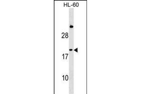IFNA1 Antikörper  (C-Term)