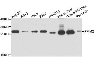 Western blot analysis of extracts of various cell lines, using PMM2 antibody. (PMM2 Antikörper)