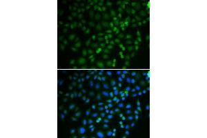 Immunofluorescence (IF) image for anti-Tripartite Motif Containing 21 (TRIM21) (AA 80-330) antibody (ABIN3015762) (TRIM21 Antikörper  (AA 80-330))