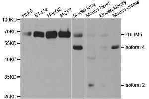 Western blot analysis of extracts of various cell lines, using PDLIM5 antibody. (PDLIM5 Antikörper  (AA 317-596))