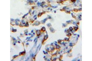 Used in DAB staining on fromalin fixed paraffin-embedded lung tissue (CEACAM6 Antikörper  (AA 35-142))