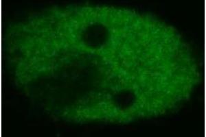 Confocal microscopy of human HeLa cells using anti-p53 (BP53-12 ; FITC). (p53 Antikörper  (FITC))
