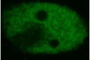 Confocal microscopy of human HeLa cells using anti-p53 (BP53-12 ; FITC).