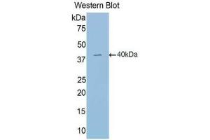 Western blot analysis of the recombinant protein. (EPAS1 Antikörper  (AA 24-348))