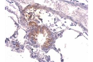 IHC-P Image Tyrosyl tRNA synthetase antibody detects YARS protein at cytosol on mouse lung by immunohistochemical analysis.