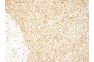 Immunohistochemistry (IHC) image for anti-Mitogen-Activated Protein Kinase Kinase Kinase MLT (ZAK) (AA 750-800) antibody (ABIN7448872) (ZAK Antikörper  (AA 750-800))