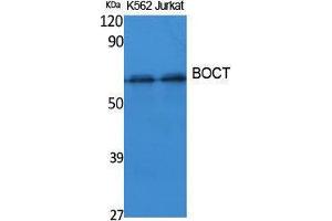 Western Blotting (WB) image for anti-Solute Carrier Family 22 (Organic Cation Transporter), Member 17 (SLC22A17) (Internal Region) antibody (ABIN3187626) (SLC22A17 Antikörper  (Internal Region))