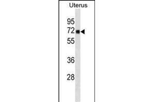 TRMT1 Antibody (N-term) (ABIN1881903 and ABIN2838437) western blot analysis in human Uterus tissue lysates (35 μg/lane). (TRMT1 Antikörper  (N-Term))