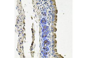 Immunohistochemistry of paraffin-embedded mouse lung using FLT1 antibody at dilution of 1:100 (x40 lens).