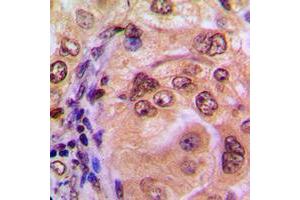 Immunohistochemistry (IHC) image for anti-Nuclear Factor of kappa Light Polypeptide Gene Enhancer in B-Cells 1 (NFKB1) (C-Term) antibody (ABIN7296414)