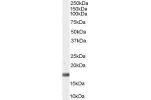 Image no. 1 for anti-Peptidylprolyl Cis/trans Isomerase, NIMA-Interacting 1 (PIN1) (Internal Region) antibody (ABIN374746) (PIN1 Antikörper  (Internal Region))