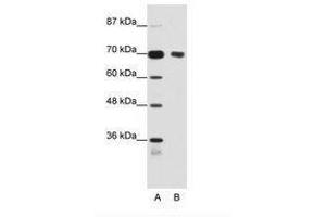 Image no. 1 for anti-Tripartite Motif Containing 32 (TRIM32) (N-Term) antibody (ABIN202853) (TRIM32 Antikörper  (N-Term))