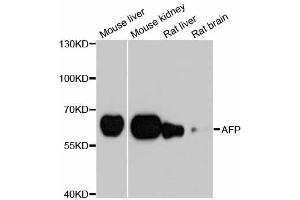 Western blot analysis of extracts of various cell lines, using AFP antibody. (alpha Fetoprotein Antikörper)