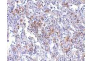 Immunohistochemistry of EVER1 in human spleen with EVER1 antibody at 2.