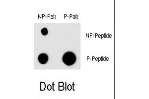 Dot Blot (DB) image for anti-Epidermal Growth Factor Receptor (EGFR) (pTyr998) antibody (ABIN2970999)