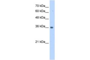 Western Blotting (WB) image for anti-TruB Pseudouridine (Psi) Synthase Homolog 2 (TRUB2) antibody (ABIN2463175) (TRUB2 Antikörper)