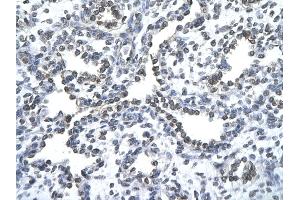 Human Lung; Rabbit Anti-ZNF212 antibody. (ZNF212 Antikörper  (N-Term))