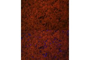 Immunofluorescence analysis of mouse brain using SN Rabbit pAb (ABIN3021231, ABIN3021232, ABIN3021233 and ABIN6214078) at dilution of 1:100 (40x lens). (SNAP25 Antikörper  (AA 1-206))