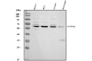 Western blot analysis of CYP1B1 using anti-CYP1B1 antibody (ABIN3042785).