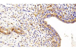 Detection of Kim1 in Rat Uterus Tissue using Polyclonal Antibody to Kidney Injury Molecule 1 (Kim1)