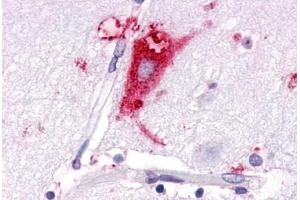 Anti-GPR63 antibody  ABIN1048855 IHC staining of human brain, neurons and glia. (GPR63 Antikörper  (C-Term))