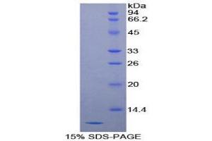 SDS-PAGE (SDS) image for serpin Peptidase Inhibitor, Clade B (Ovalbumin), Member 4 (SERPINB4) (AA 320-390) protein (His tag) (ABIN1080831)