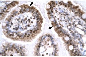 Rabbit Anti-EGR1 Antibody Catalog Number: ARP32241 Paraffin Embedded Tissue: Human Intestine Cellular Data: Epithelial cells of intestinal villas Antibody Concentration: 4. (EGR1 Antikörper  (N-Term))