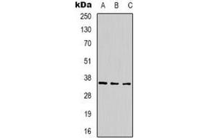 Western blot analysis of CABP2 expression in 293T (A), mouse brain (B), rat brain (C) whole cell lysates. (CABP2 Antikörper)