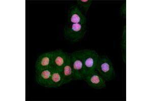 Immunofluorescence (IF) image for anti-Ataxia Telangiectasia Mutated (ATM) (phosphorylated) antibody (ABIN2666314) (ATM Antikörper  (phosphorylated))