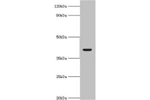Western blot All lanes: Alcohol dehydrogenase 4 antibody at 2 μg/mL + Mouse liver tissue Secondary Goat polyclonal to rabbit IgG at 1/10000 dilution Predicted band size: 41, 43 kDa Observed band size: 41 kDa (ADH4 Antikörper  (AA 1-380))