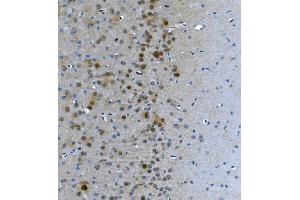 IHC analysis of LSM7 using anti-LSM7 antibody (ABIN7598937).