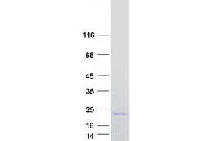 Validation with Western Blot (LTC4S Protein (Myc-DYKDDDDK Tag))