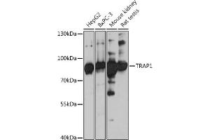 Western blot analysis of extracts of various cell lines, using TR antibody (ABIN1683134, ABIN5664756, ABIN5664758 and ABIN6220605) at 1:3000 dilution. (TRAP1 Antikörper  (AA 445-704))