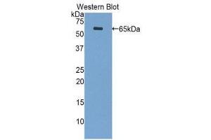 Western Blotting (WB) image for anti-Periplakin (PPL) (AA 1439-1716) antibody (ABIN1860293)
