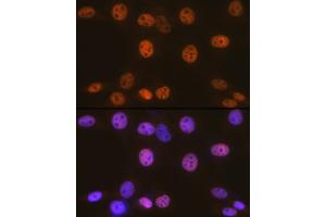 Immunofluorescence (IF) image for anti-SWI/SNF Related, Matrix Associated, Actin Dependent Regulator of Chromatin, Subfamily C, Member 1 (SMARCC1) antibody (ABIN7270658)