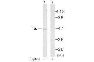 Image no. 1 for anti-Microtubule-Associated Protein tau (MAPT) (Ser235) antibody (ABIN197261) (MAPT Antikörper  (Ser235))