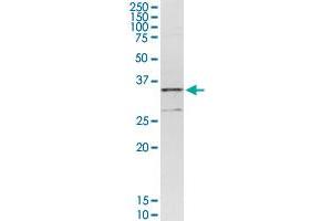 CENPH MaxPab rabbit polyclonal antibody. (CENPH Antikörper  (AA 1-247))